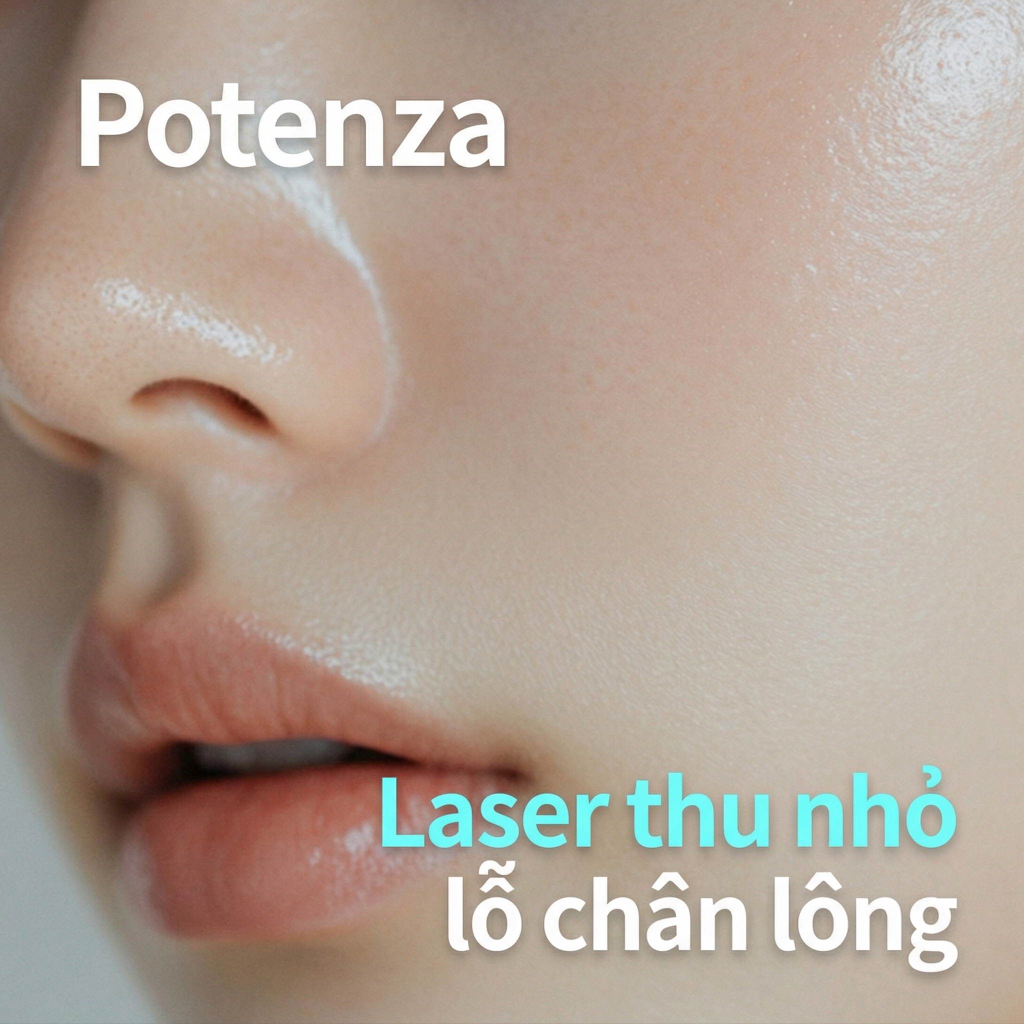 Laser tần số vô tuyến Potenza 1 lần - Chăm sóc da, thu nhỏ lỗ chân lông, cải thiện sẹo mụn & đỏ da, tăng cường đàn hồi, xóa nếp nhăn nhỏ
