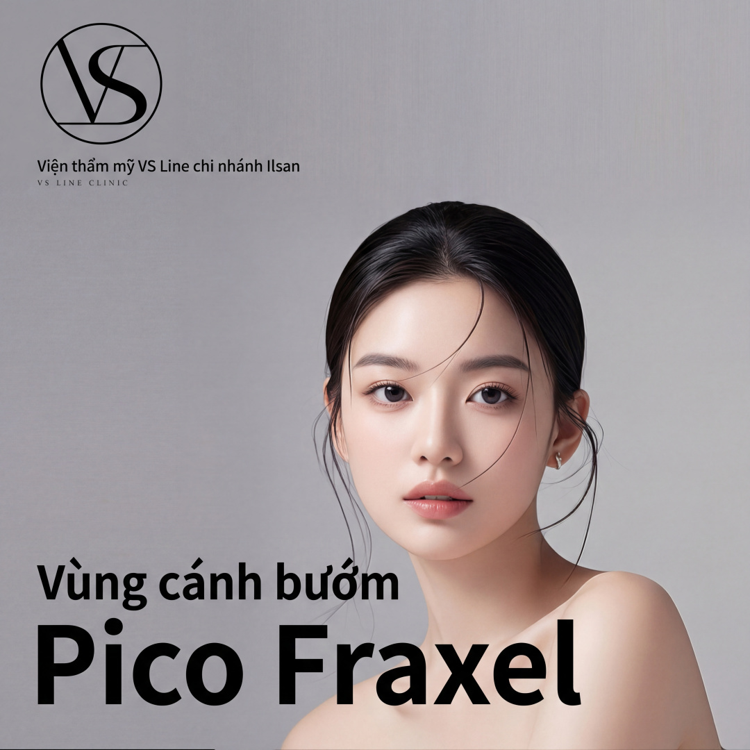 Ilsan Vùng cánh bướm Pico Fractional
