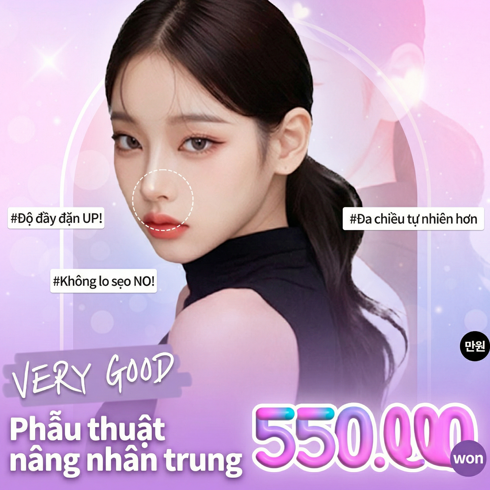 베리굿 인중오목술_인중축소술