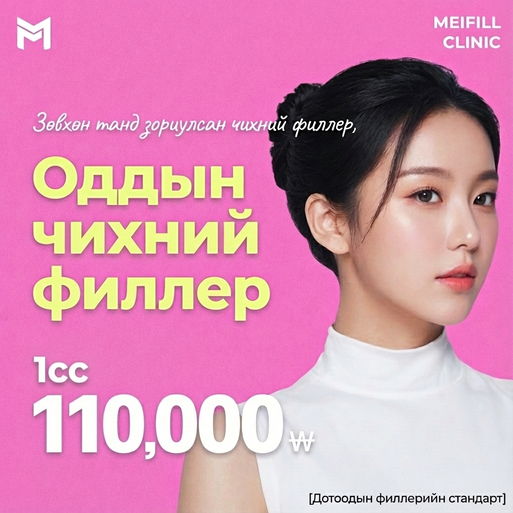 요즘 대세, 아이돌 귀필러 - 엘프귀, 요정귀, 팅커벨귀, 아이돌귀, 누운귀, 칼귀, 귓볼필러, 귀성형