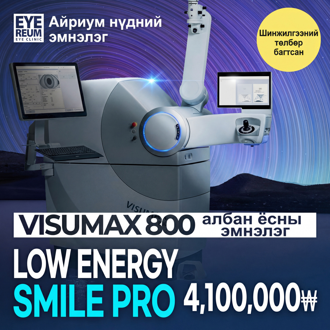 Ганнам Eyereum нүдний эмнэлэг Смайл Про Смайл ласик урамшуулал