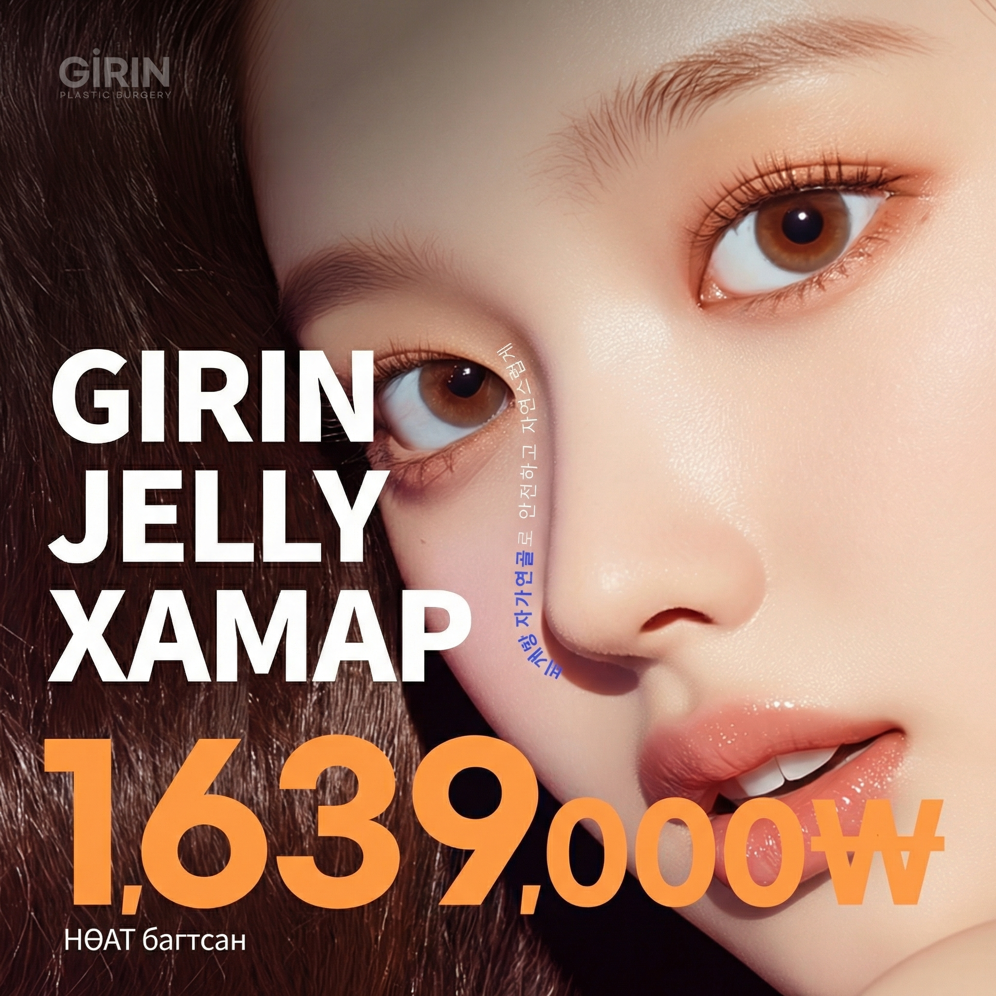 Girin Jelly хамар, дэгжин нээлттэй бус мэс засал, нуруу, бөгтөр, давтан, хамар уруулын өнцөг, үзүүр, имплантгүй