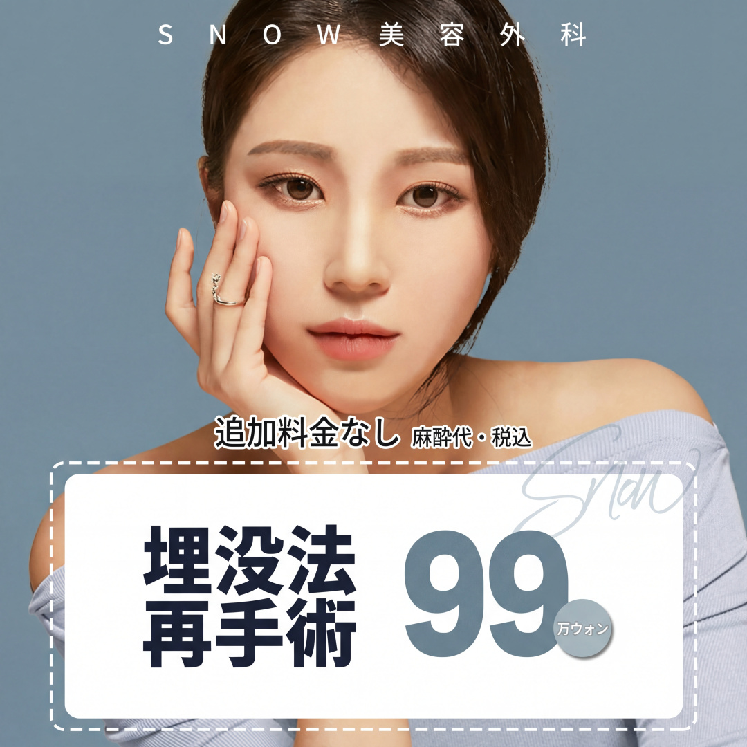 비밀눈성형 매몰재수술