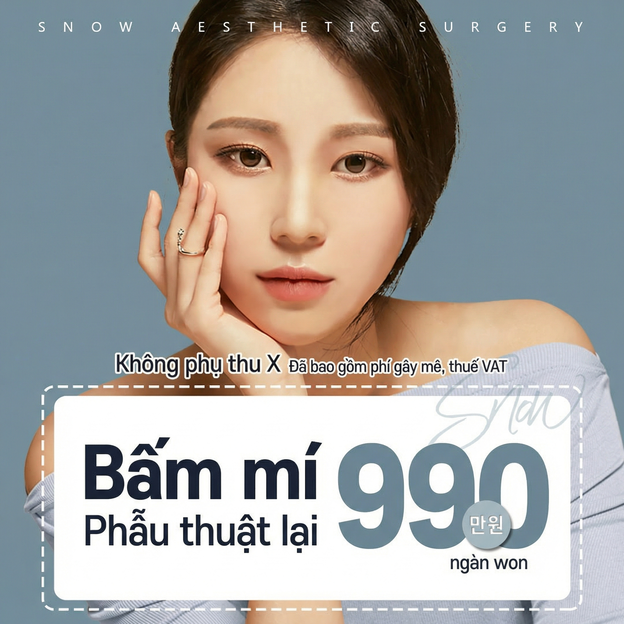 비밀눈성형 매몰재수술