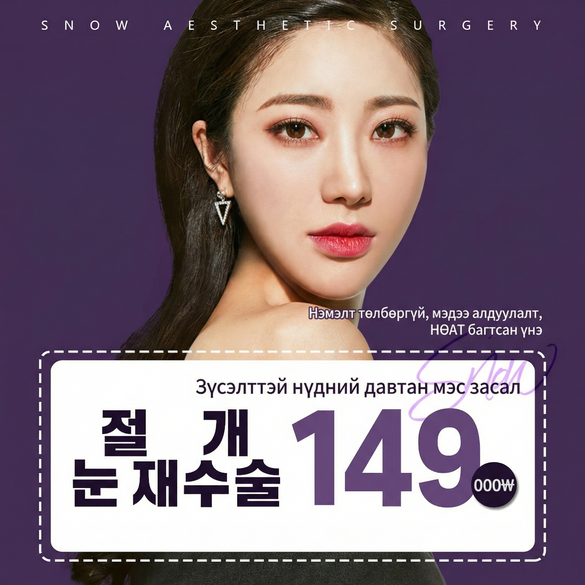 Secret Зүсэлттэй нүдний давтан мэс засал