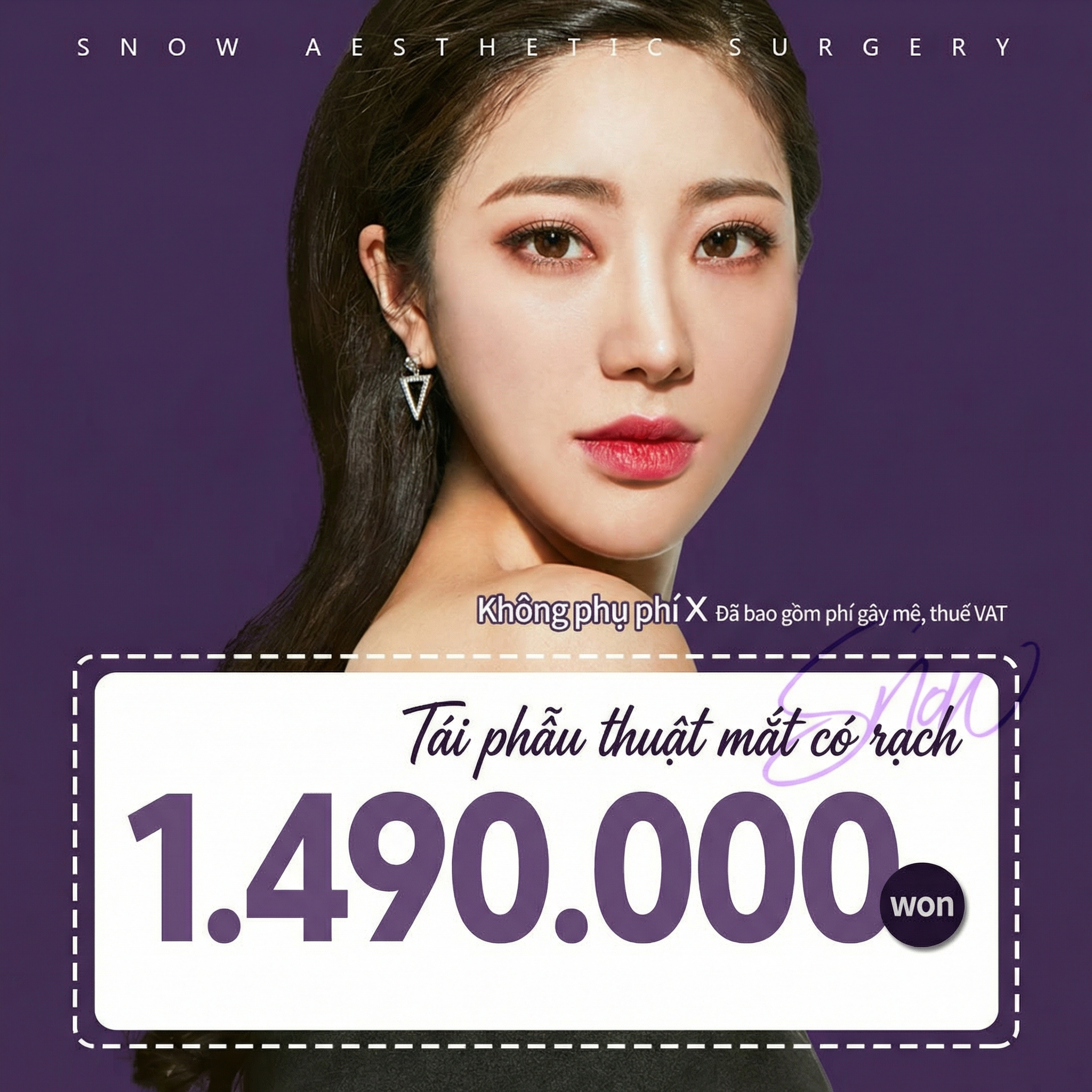 비밀눈성형 절개 눈재수술