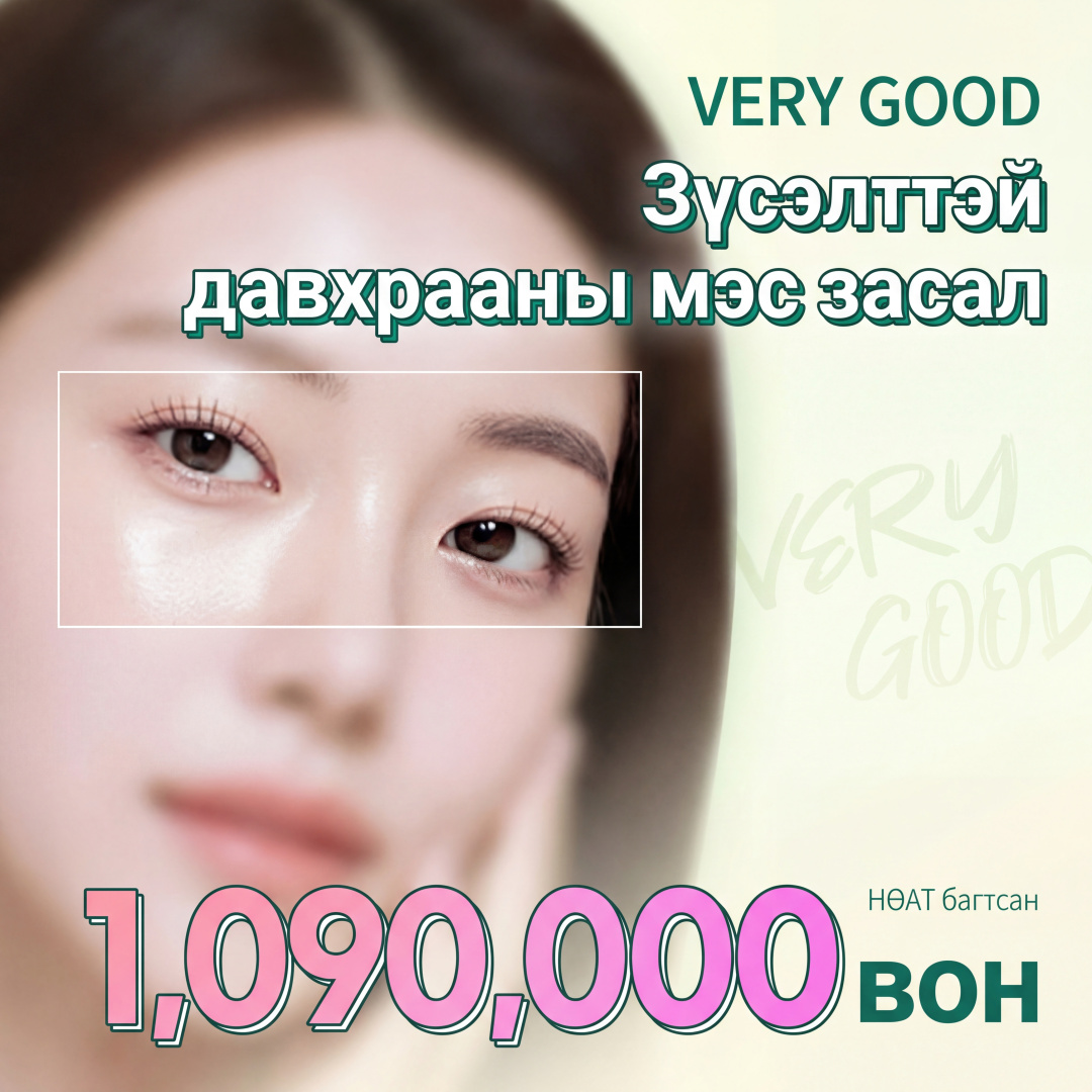 Зүсэлттэй давхраа