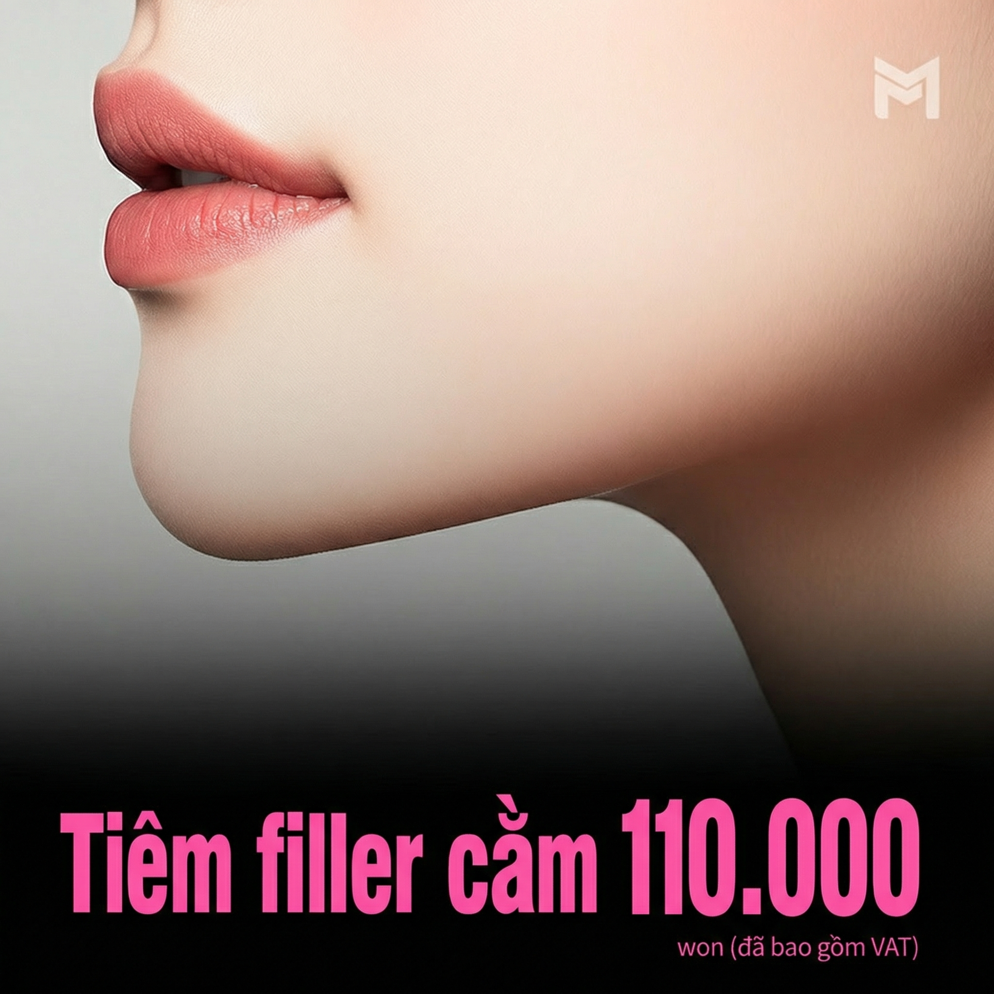 Filler cằm không phát sinh chi phí - Filler cằm trước, V-line, chỉnh hô, cằm lẹm, cải thiện đường nét khuôn mặt