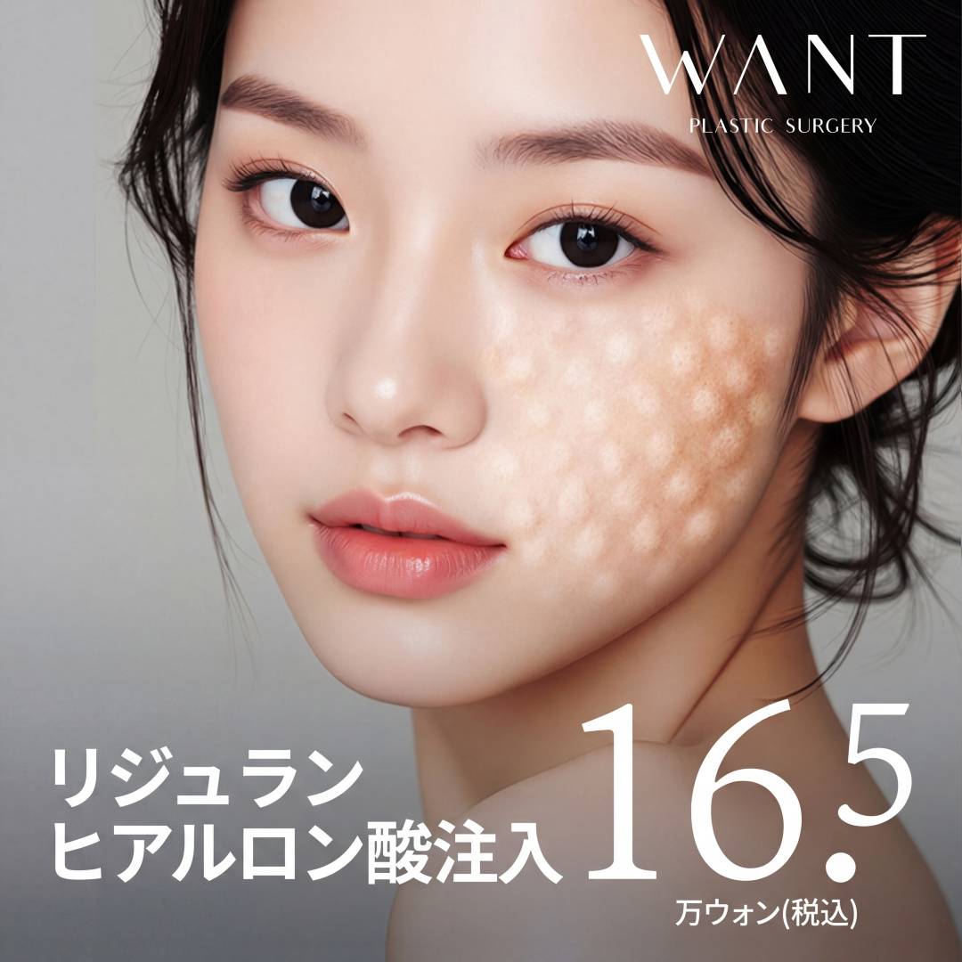 원트 리쥬란힐러