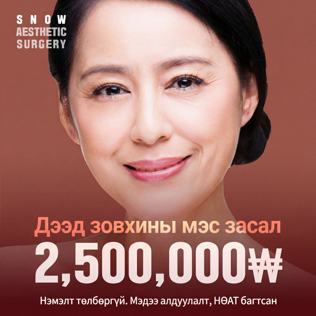 Дунд эргэм насны нүдний мэс засал Дээд зовхи Хөмсөг доогуур татах
