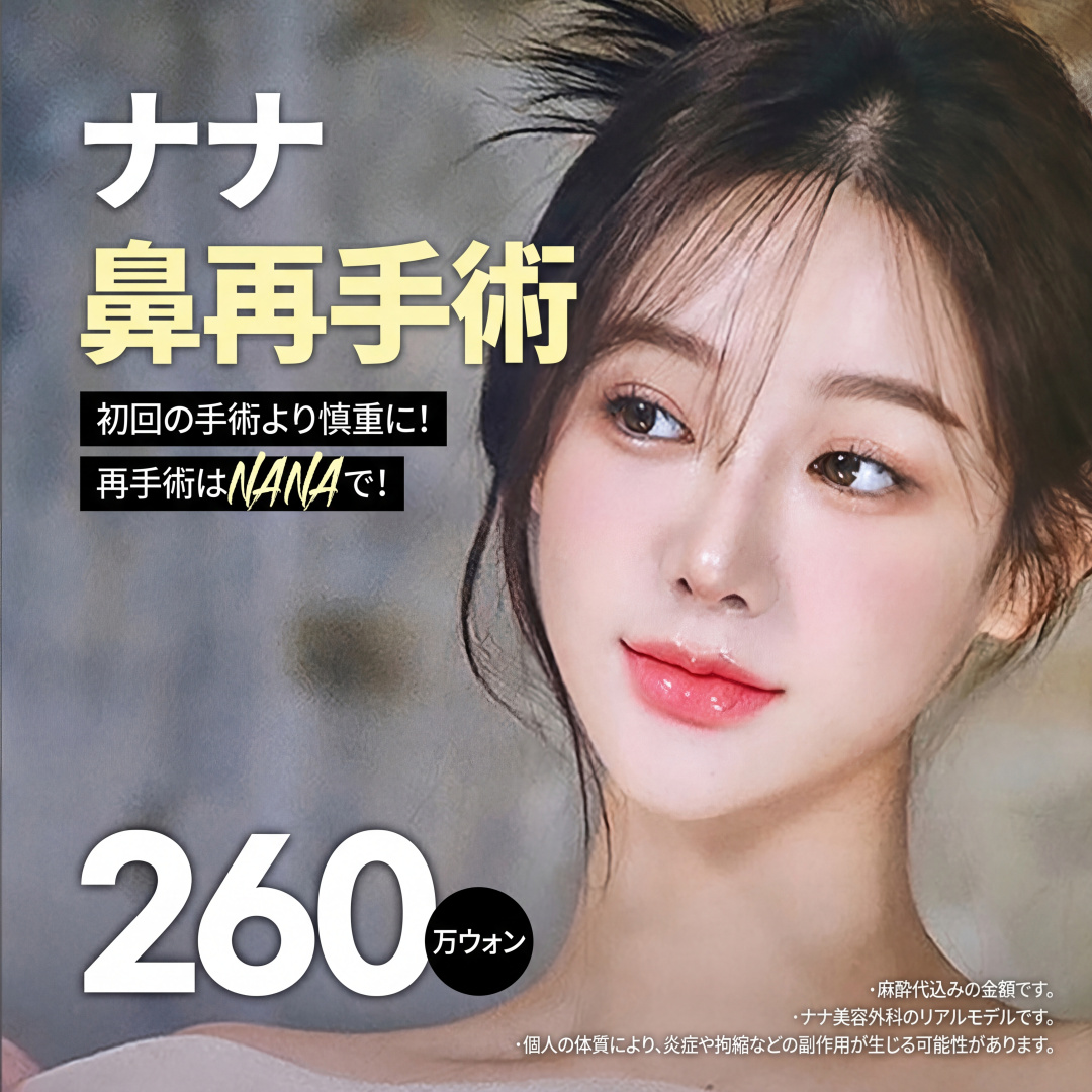 나나_코재수술_콧대 복코교정 코끝 매부리