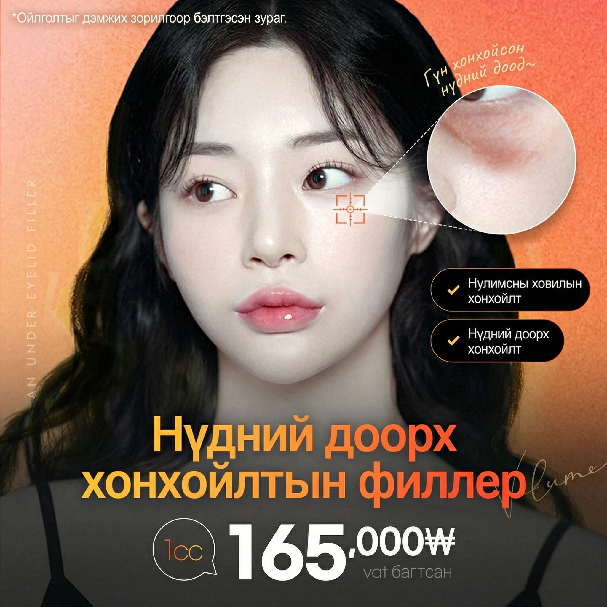 Нүдний доод хонхорхой дүүргэх филлер