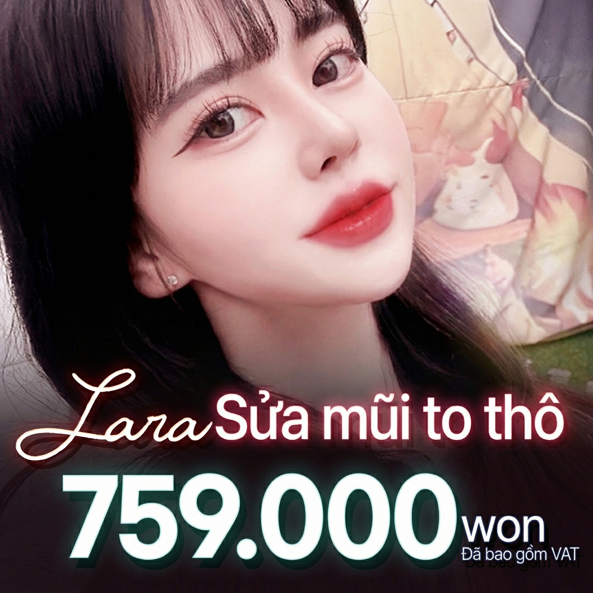 Lara_Chỉnh mũi to thon gọn