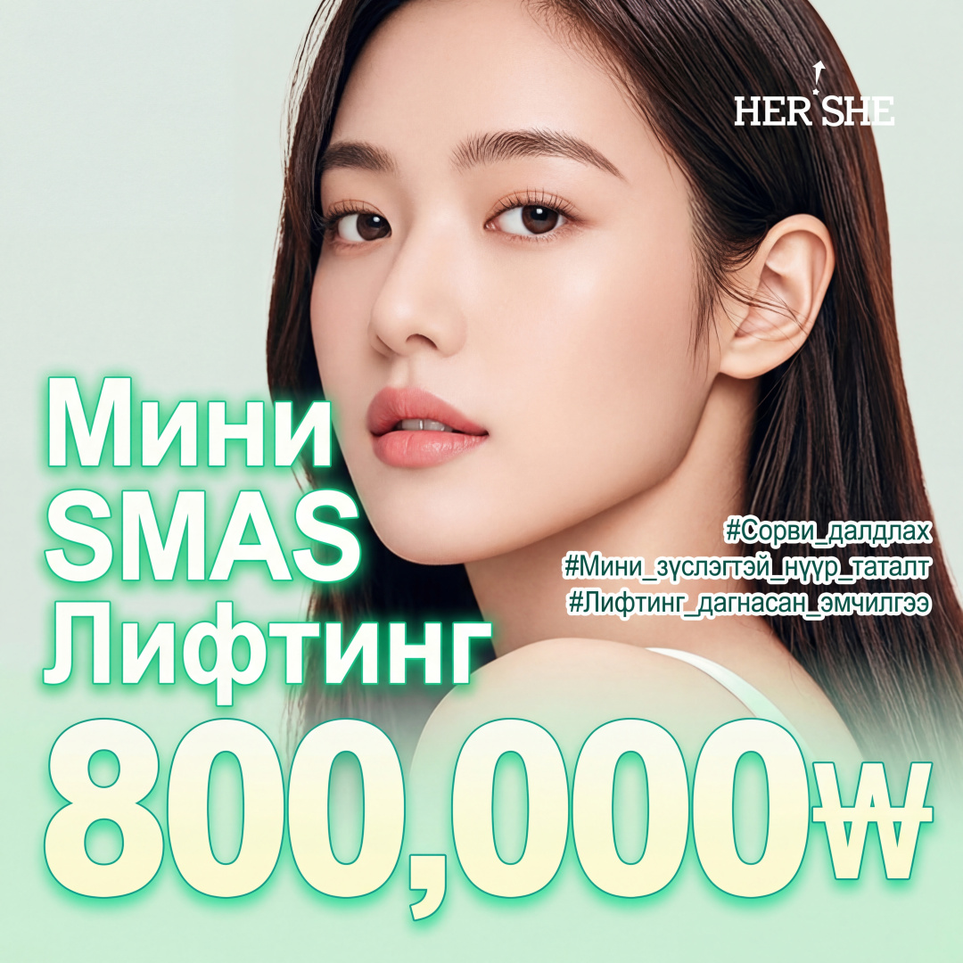 Мини СМАС лифтинг