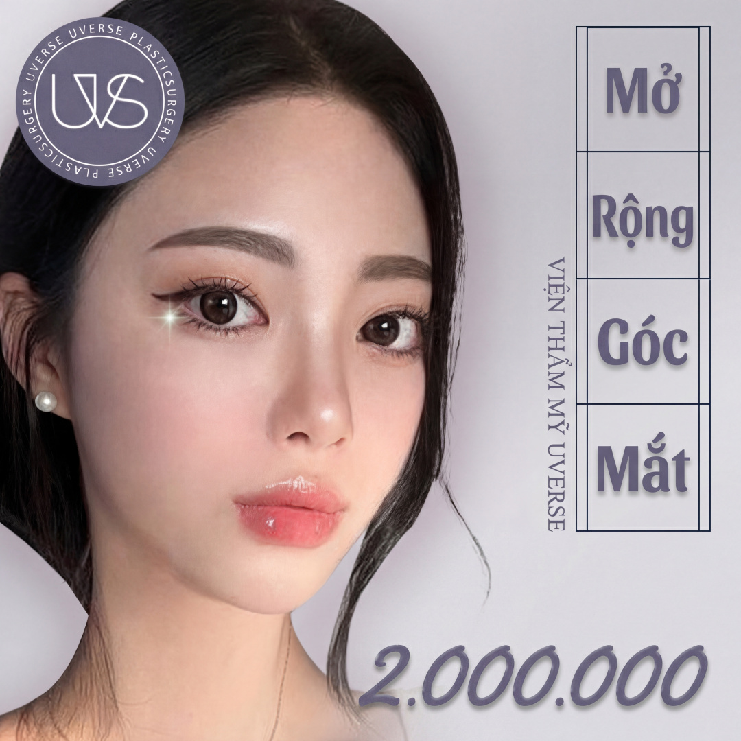 Wevers Mở góc mắt Corner