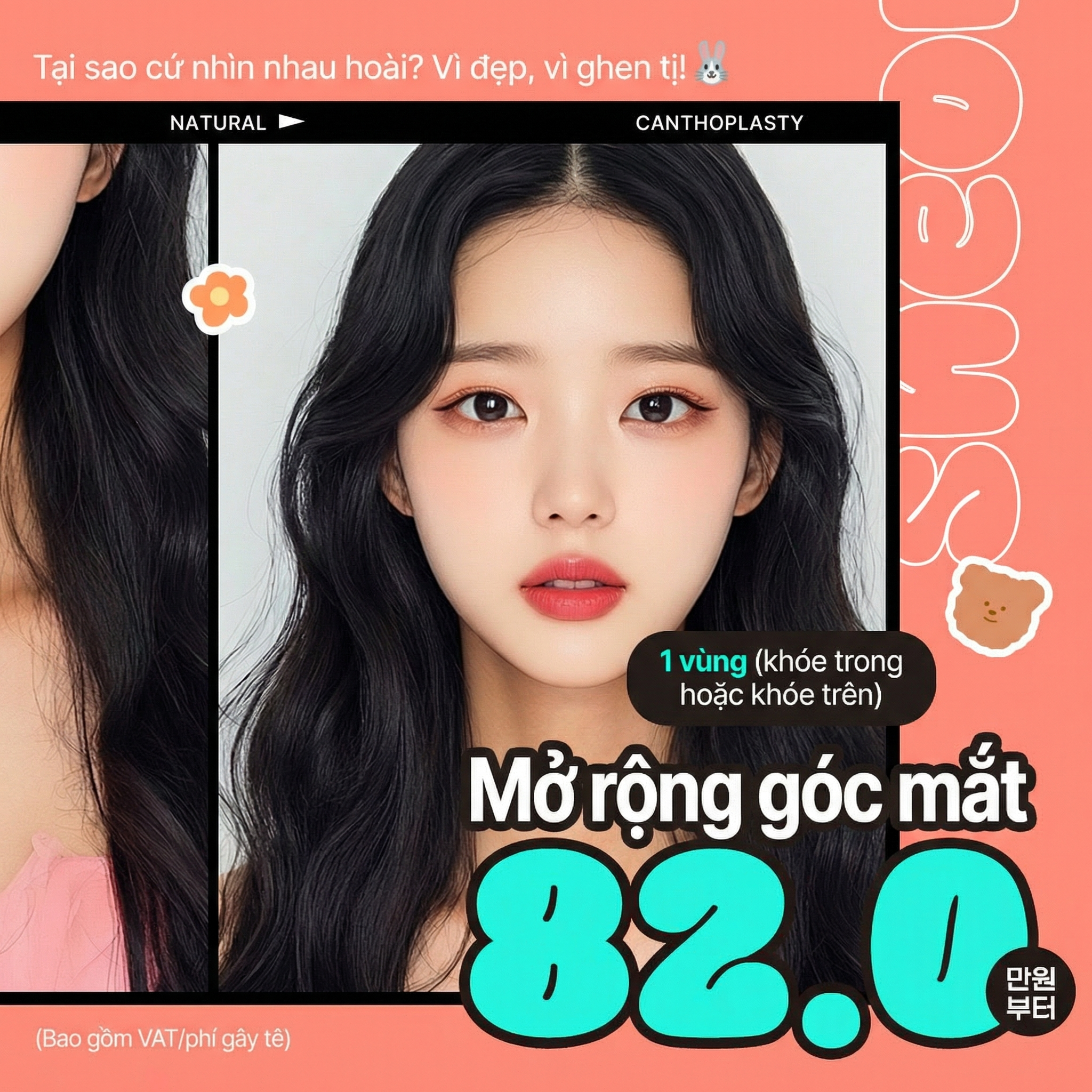 Thẩm mỹ viện Siwon Mở góc mắt Siwon