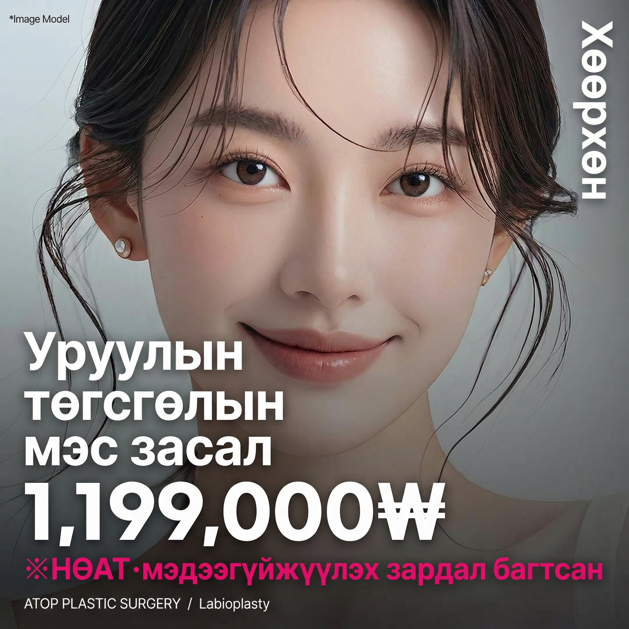 Atop Lovely Уруулын булан өргөх мэс засал