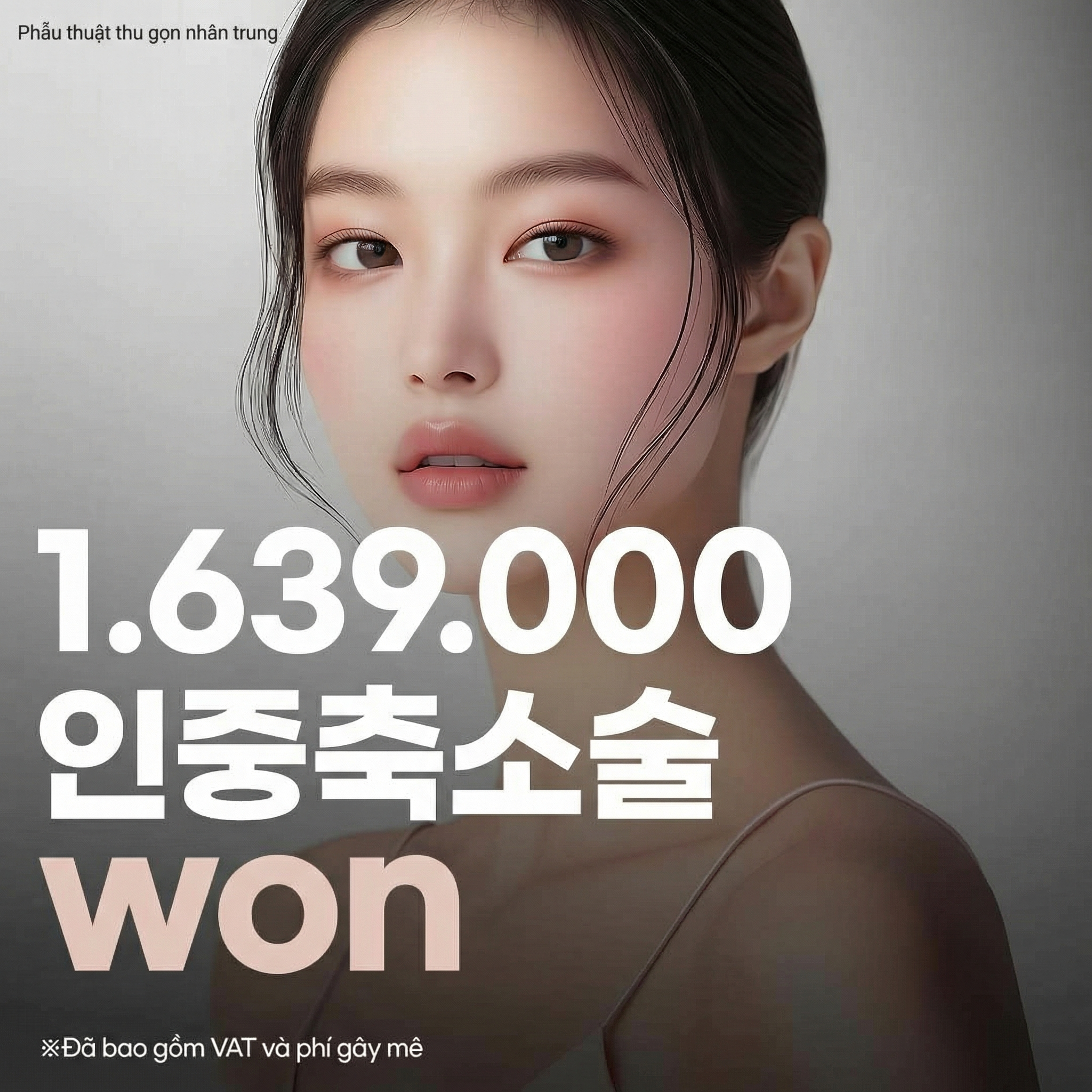 Atop Phẫu thuật thu gọn nhân trung_Thu gọn nhân trung ngoài, trong, cải thiện chiều dài trung mặt