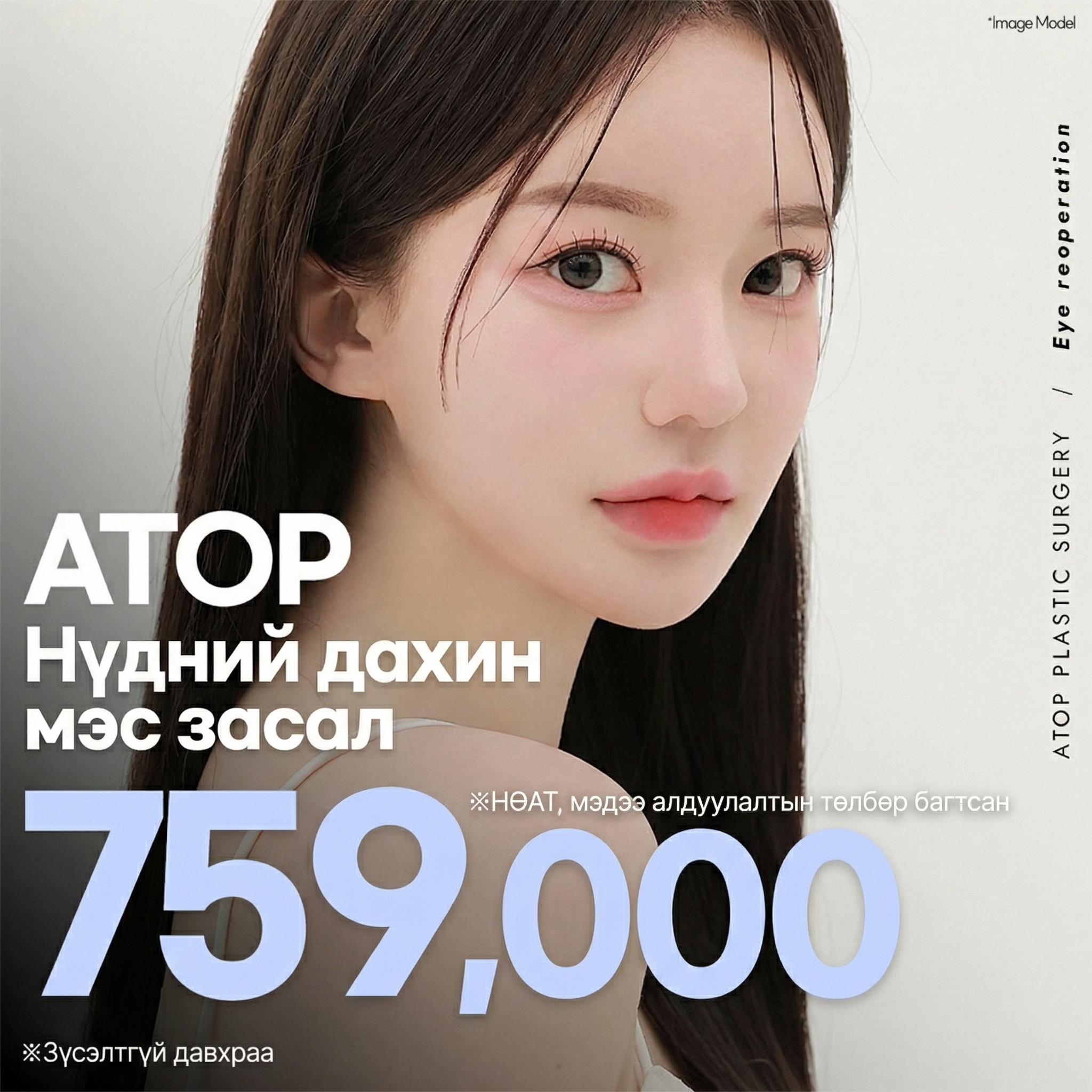 Atop Нүдний давтан мэс засал (Хөөнгө нүд, давхраа тавигдсан, шугам засах)