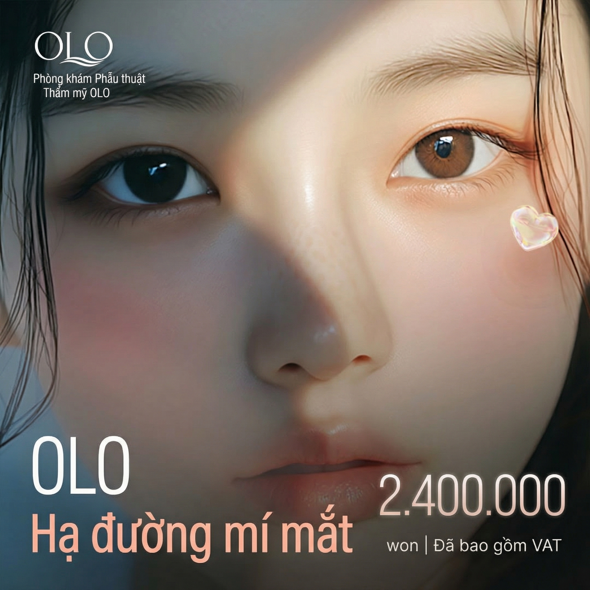 Olo Hạ size mí Tái phẫu thuật mắt