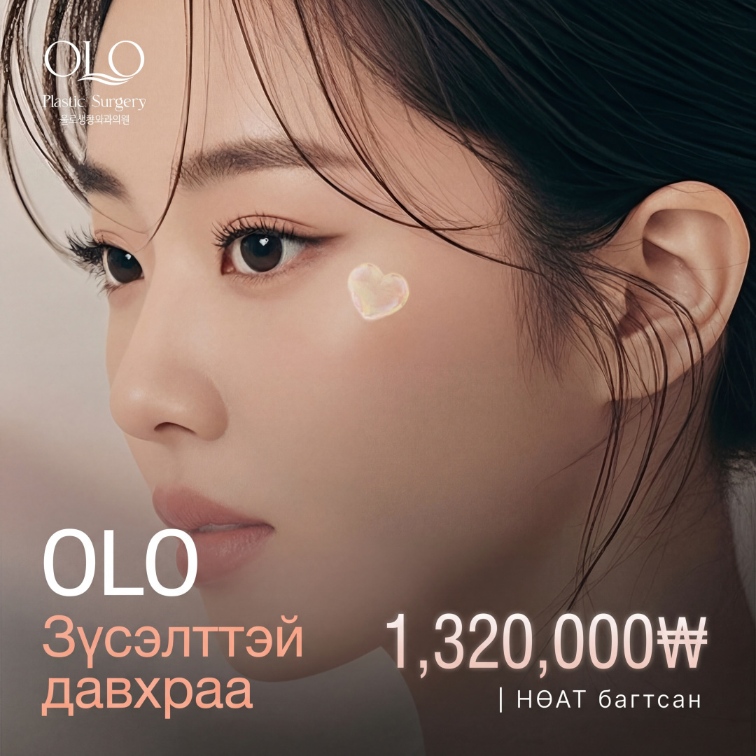 Olo Зүсэлттэй давхраа