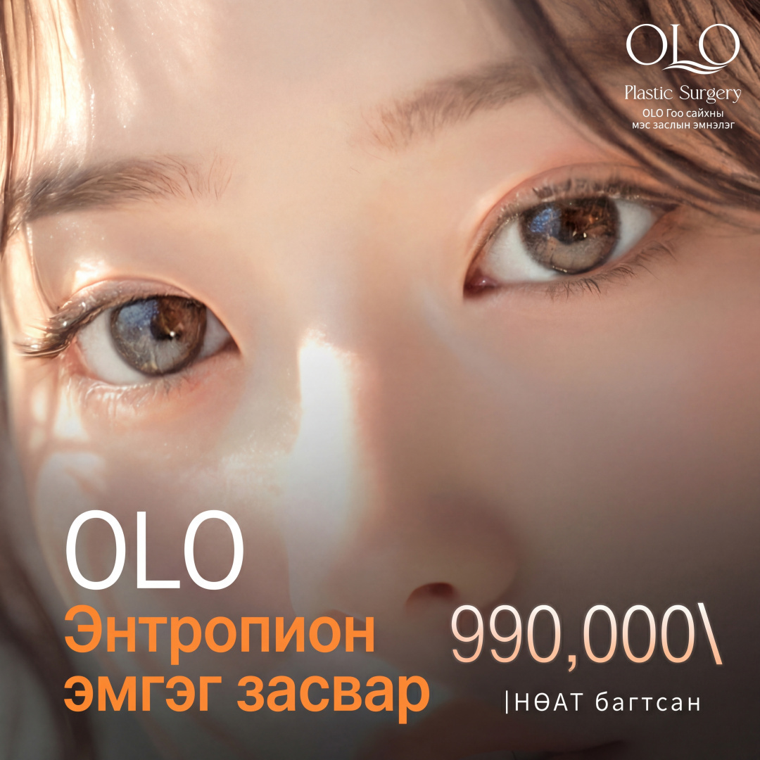 Olo Сормуус нүд рүү ургахыг засах