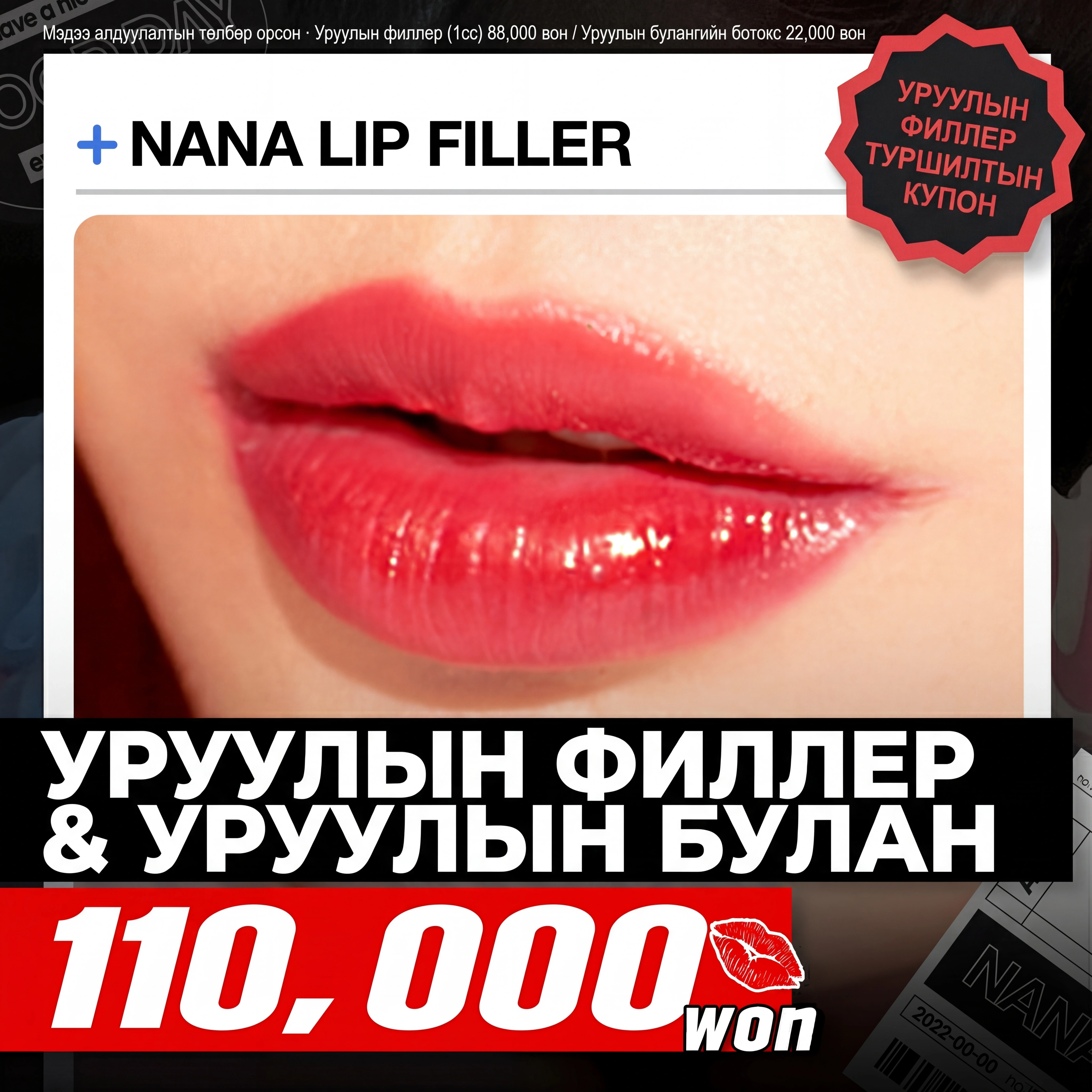 나나_입술필러&입꼬리보톡스