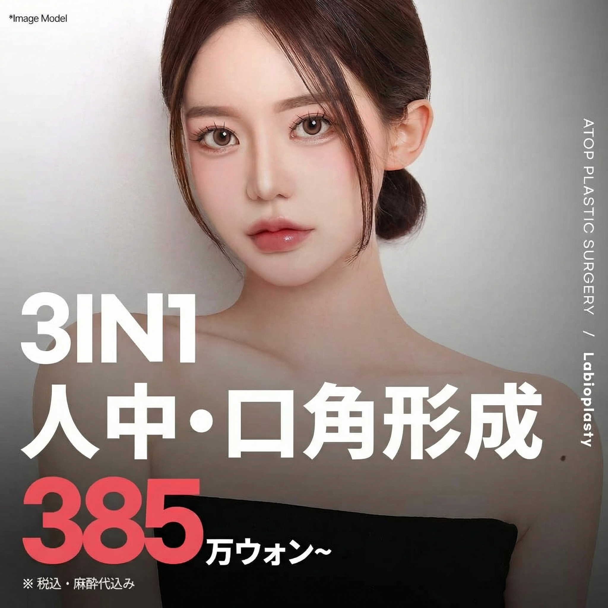 에이탑 인중입꼬리성형_인중축소, 입꼬리수술_중안면부축소효과