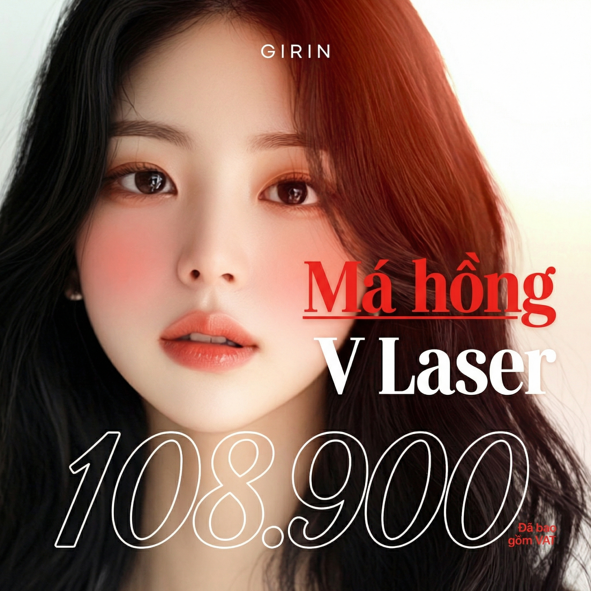 Girin Laser trị đỏ má cải thiện đỏ mặt
