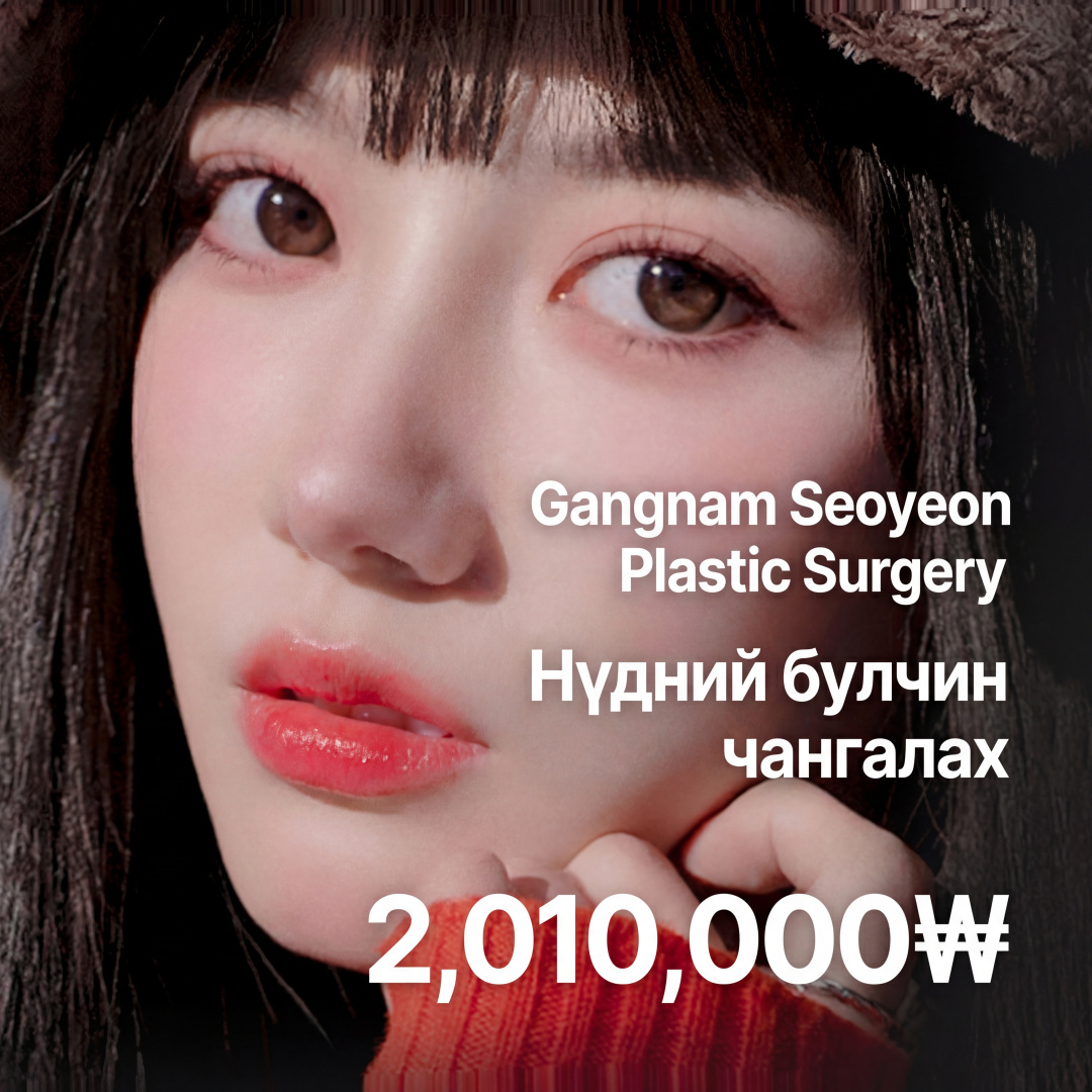 Gangnam Seoyeon Нүдний хэлбэр засах