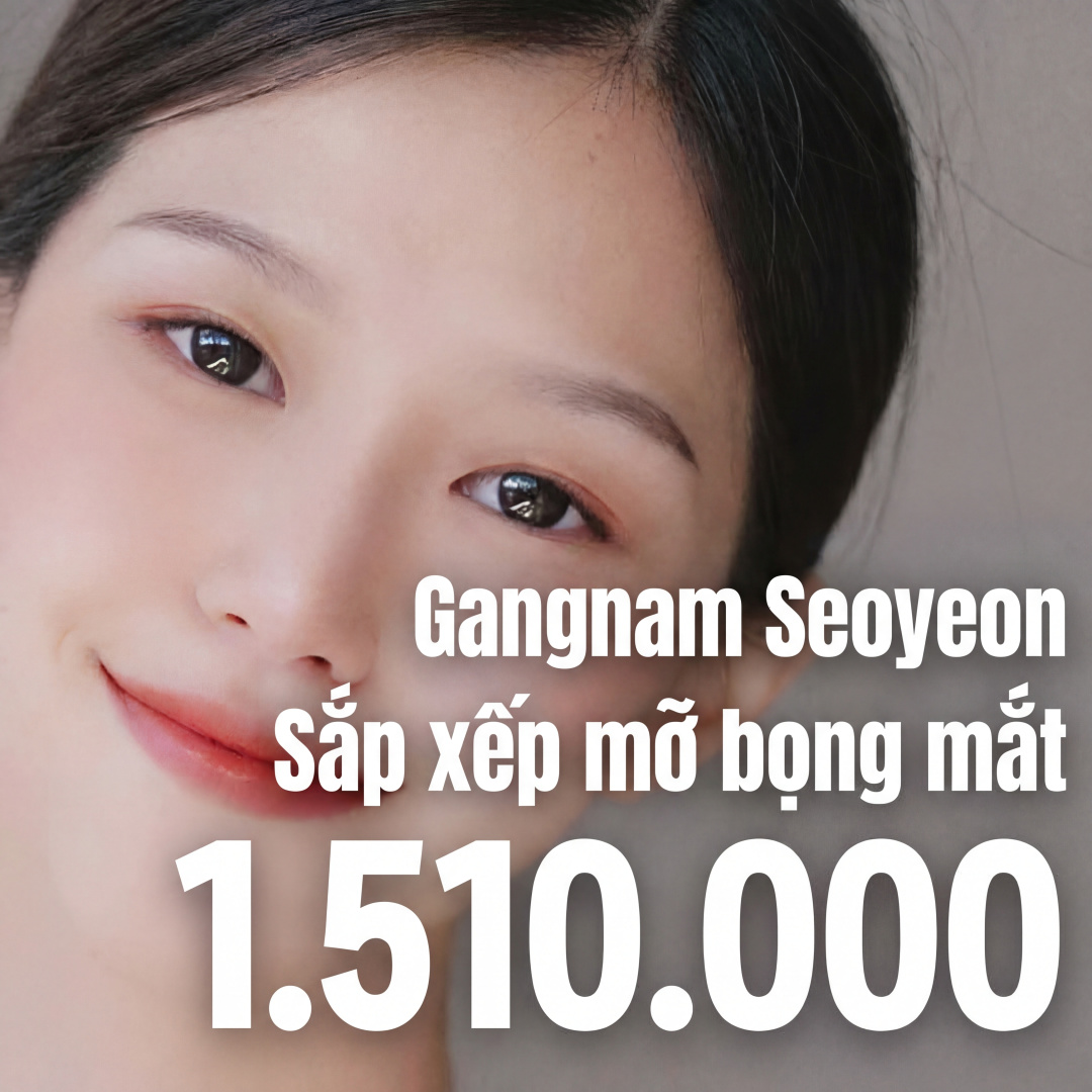 Gangnam Seoyeon Tái bố trí mỡ bọng mắt