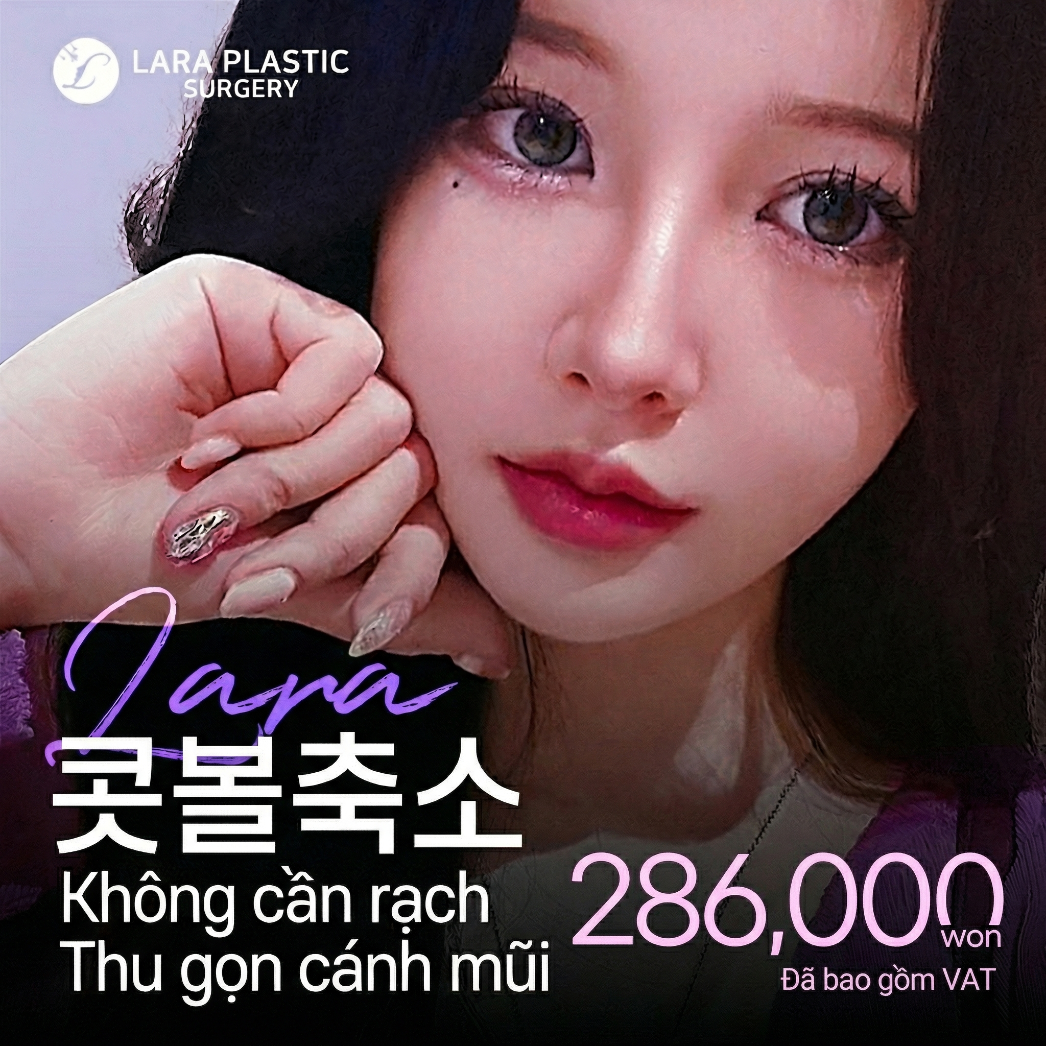 Lara_Thu cánh mũi không phẫu thuật