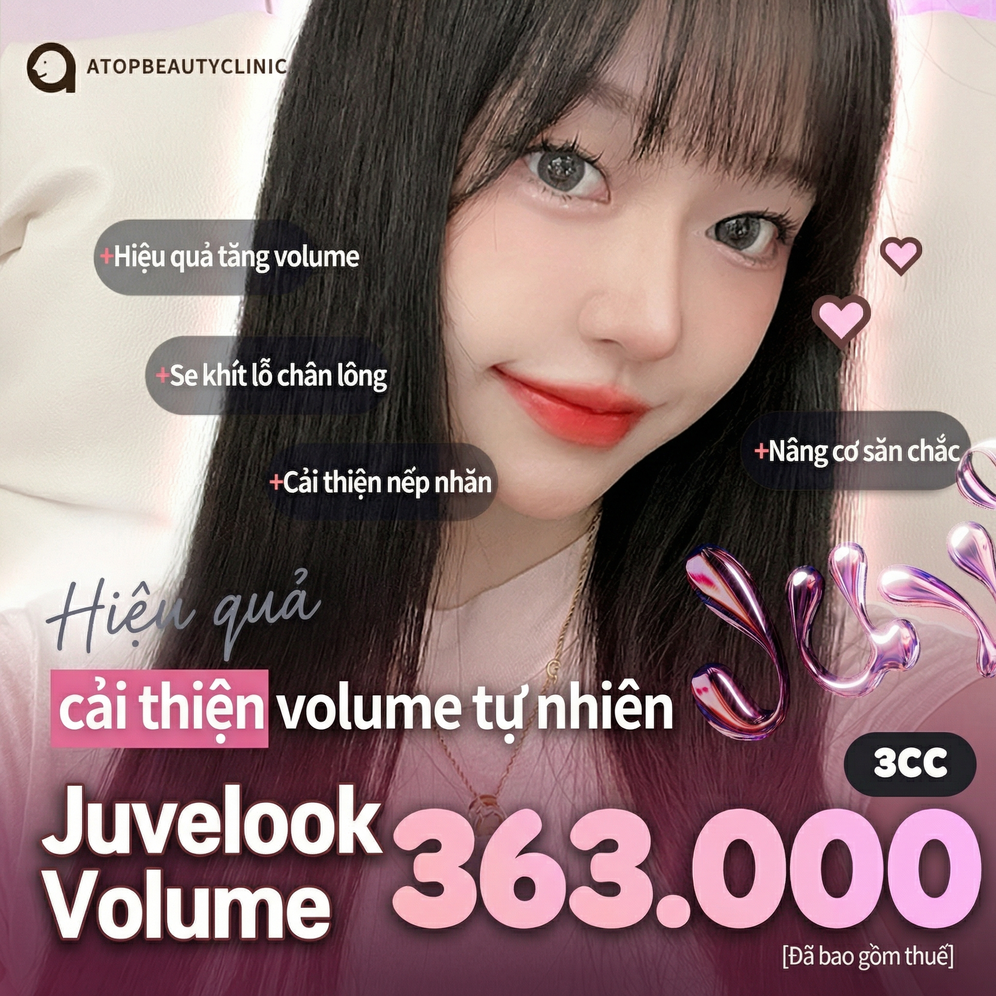 Atop Juvelook Volume_ Tiêm Collagen, Hóp má