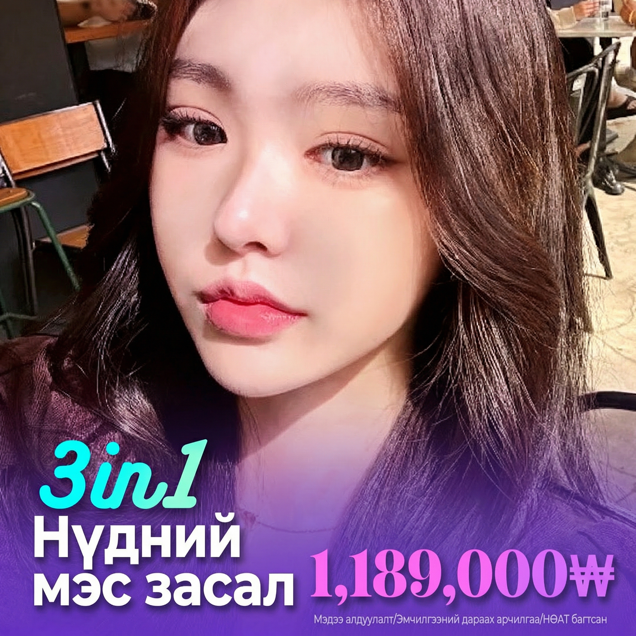 Lara 3 in 1 Нүдний мэс засал