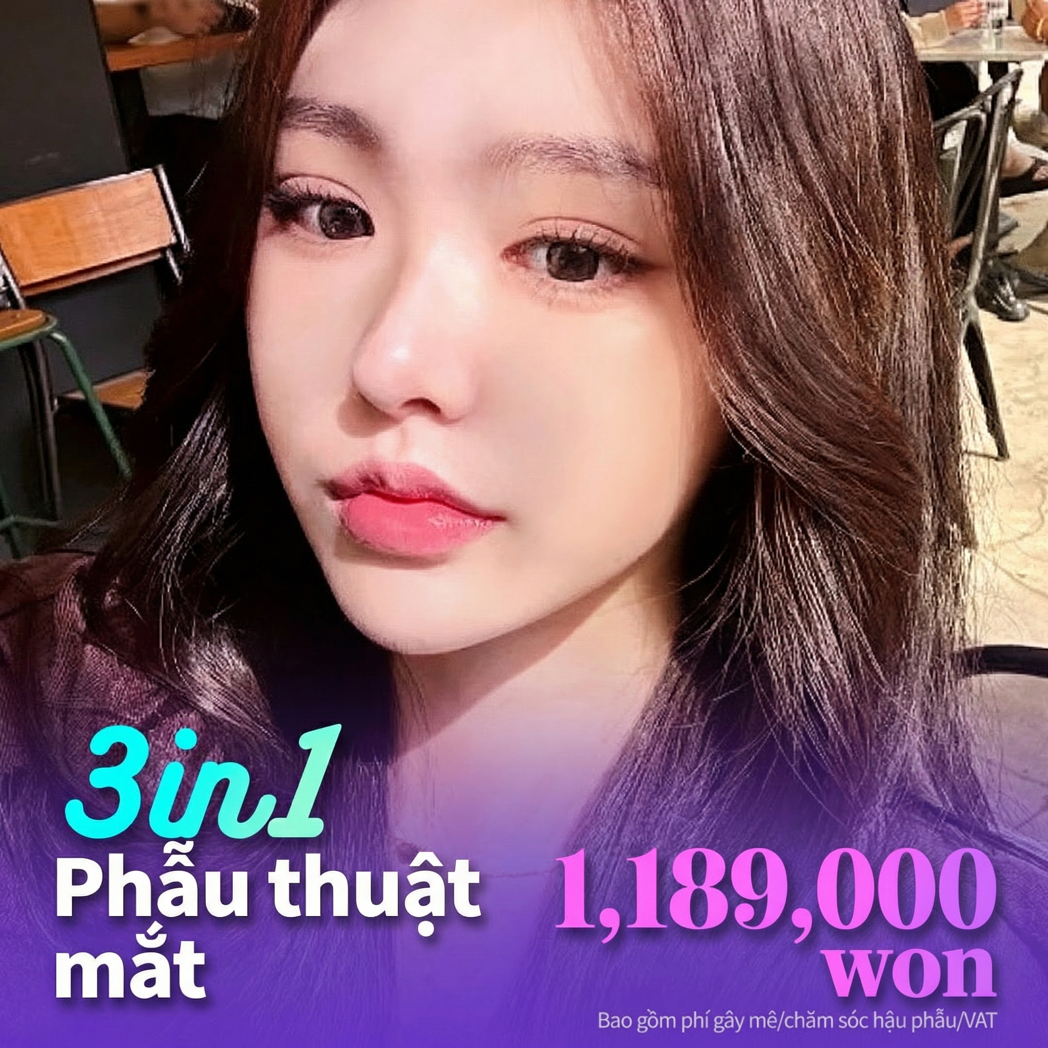 Lara_Thẩm mỹ mắt 3 in 1