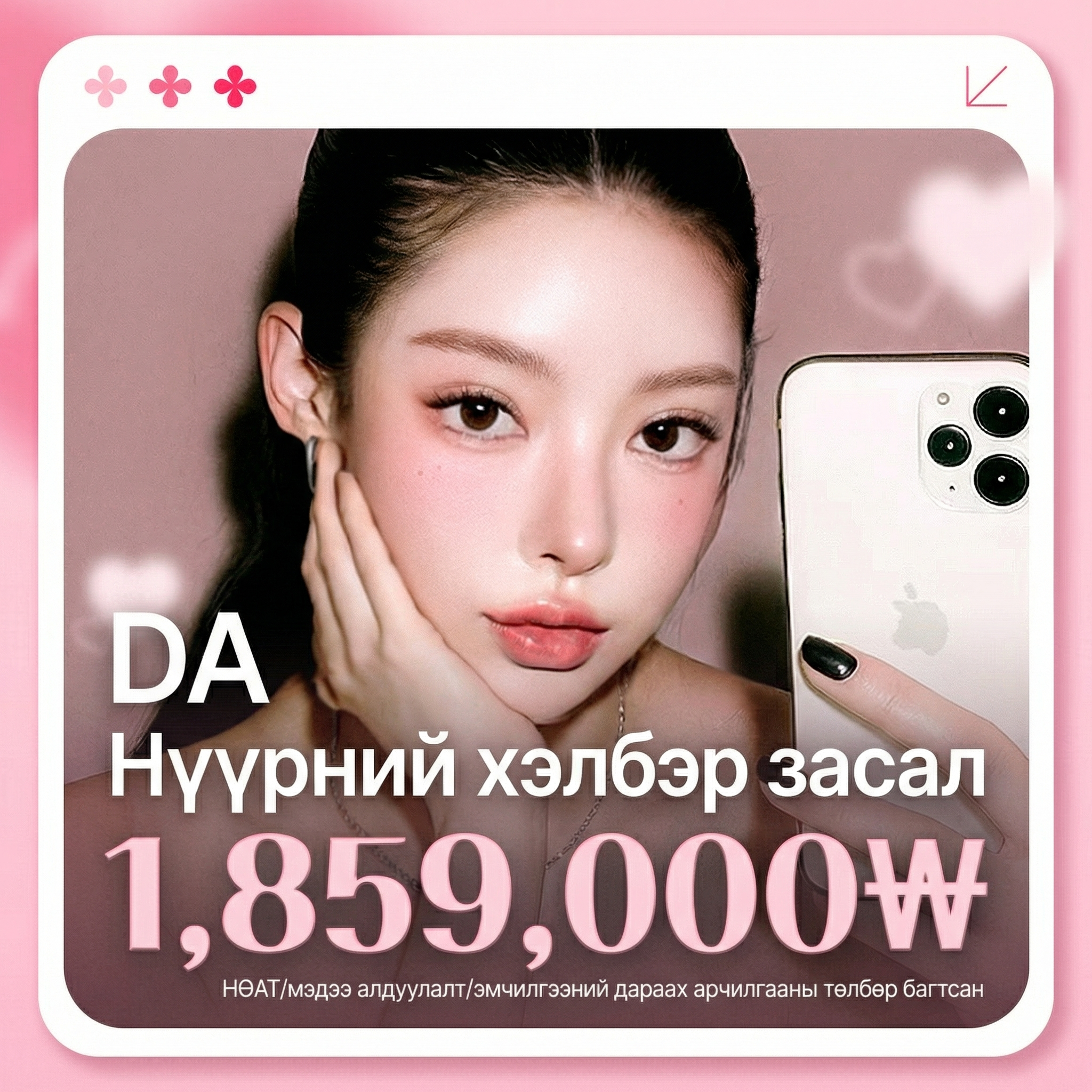 Хөөрхөн бол DA_Нүүрний хэлбэр засах_Дөрвөлжин эрүүний мэс засал Шанаа багасгах Эрүүний үзүүр янзлах Эрүүний үзүүрийн мэс засал