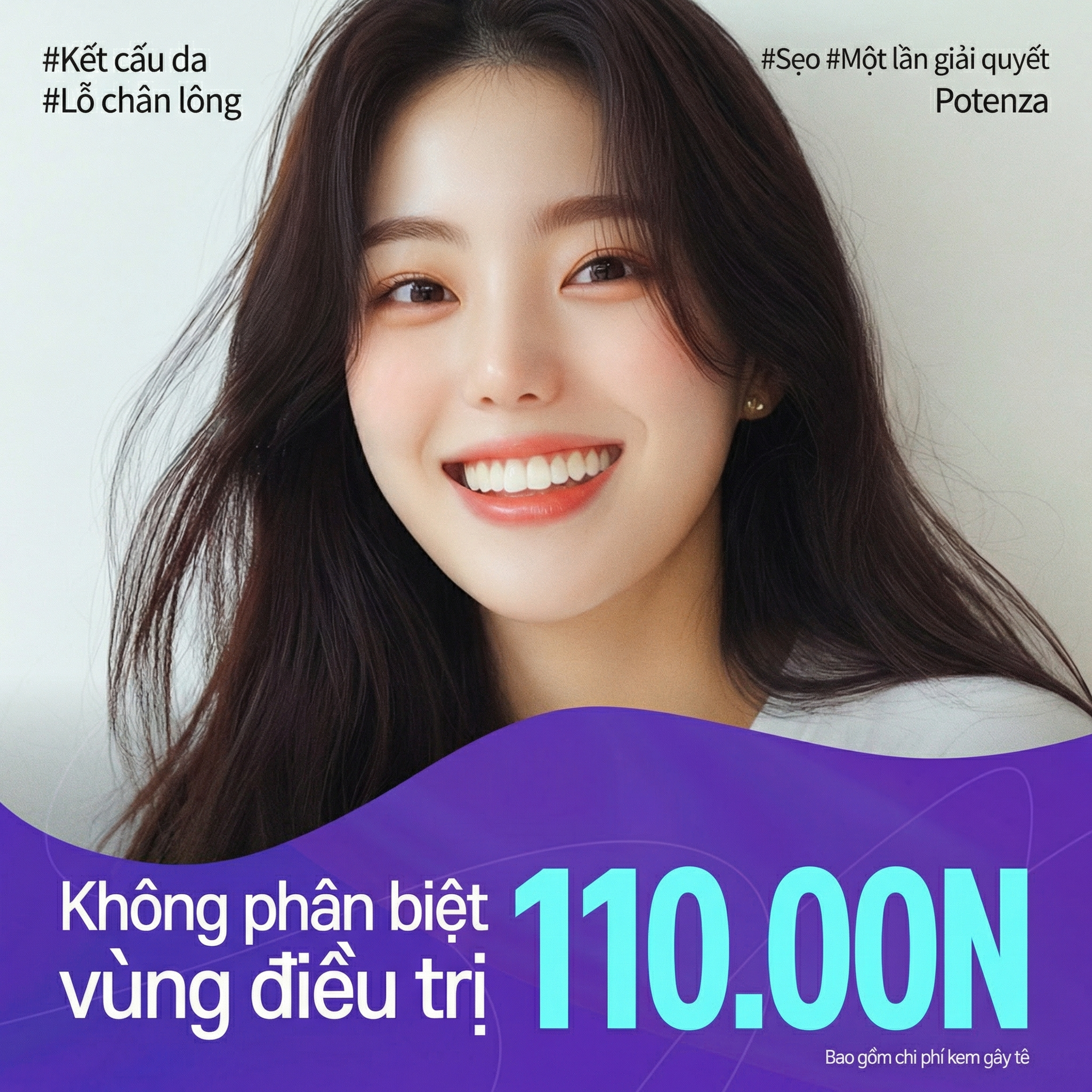 All-Lifting_Potenza_Lỗ chân lông_Kết cấu da_Xóa sẹo_PDRN