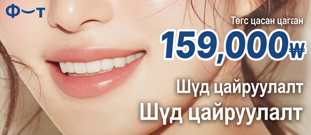 Шүд цайруулах 3 удаа, One Day шүдний эмнэлгийн цайруулах багц