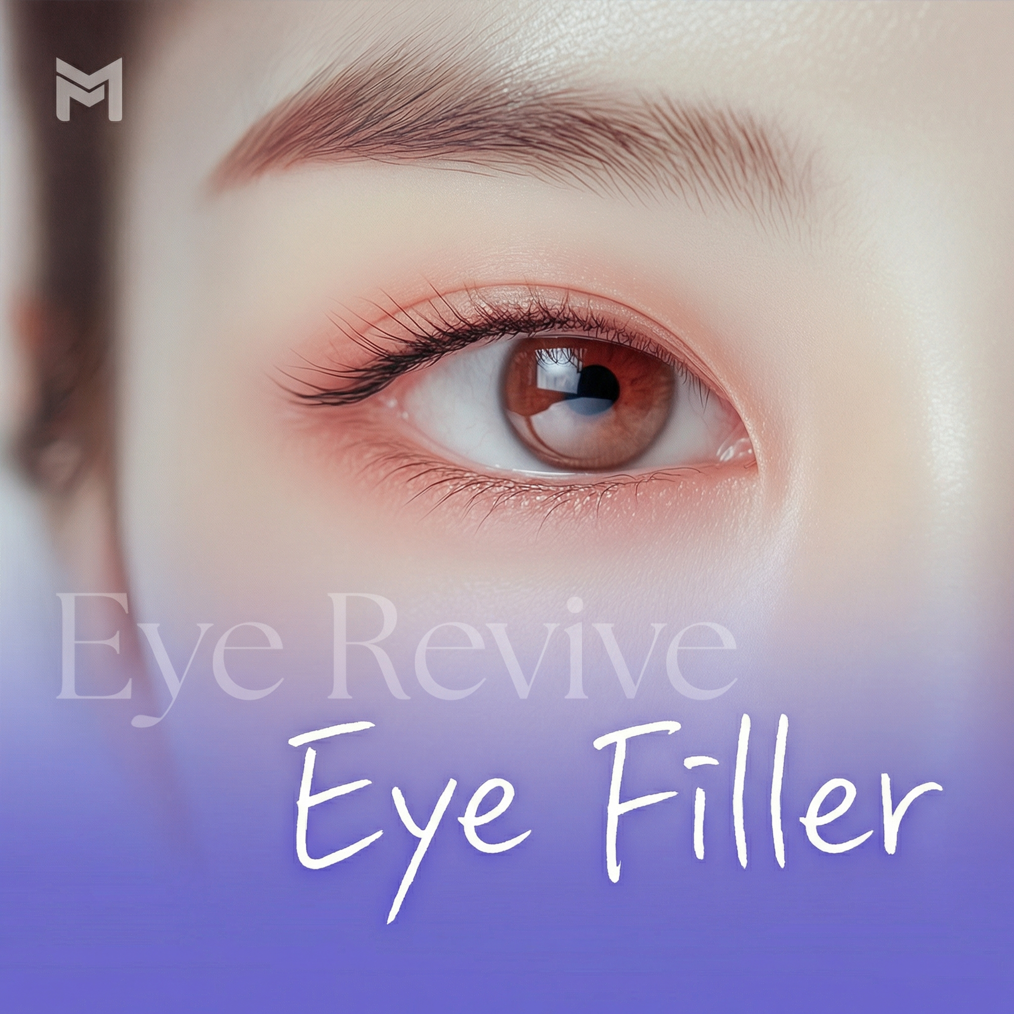 Ive Filler 1cc - Filler hốc mắt trên, mí mắt, mắt trũng, sụp mí