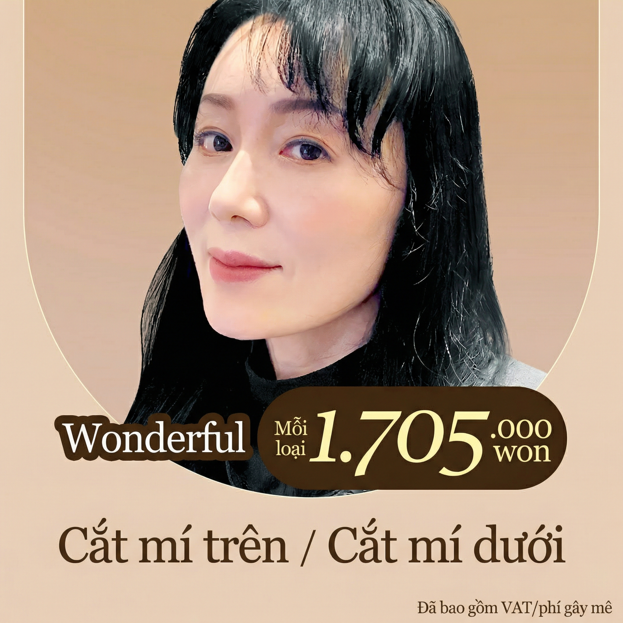 Wonderful Thẩm mỹ mắt trung niên_ Cắt mí trên, Cắt mí dưới