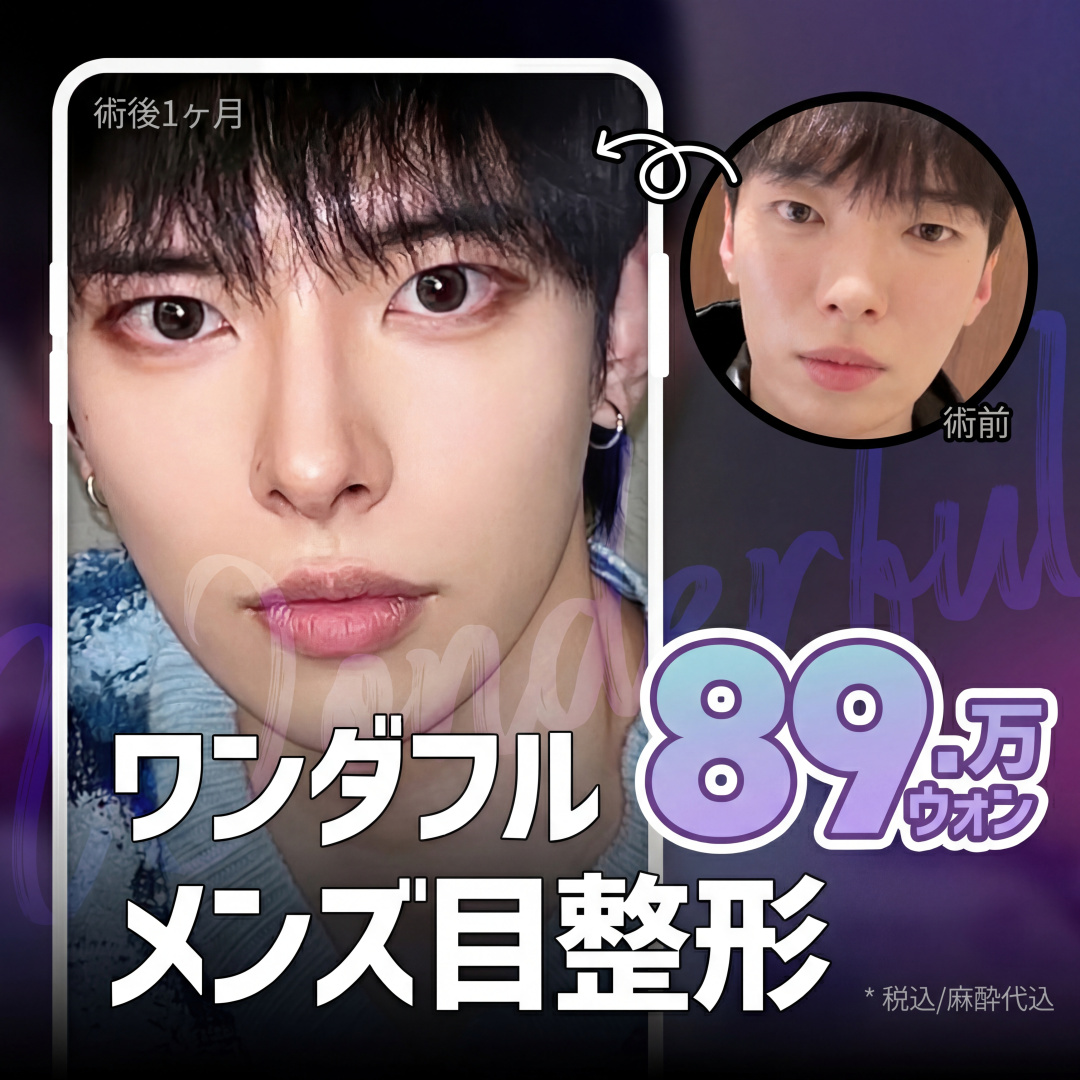 원더풀_남자눈성형