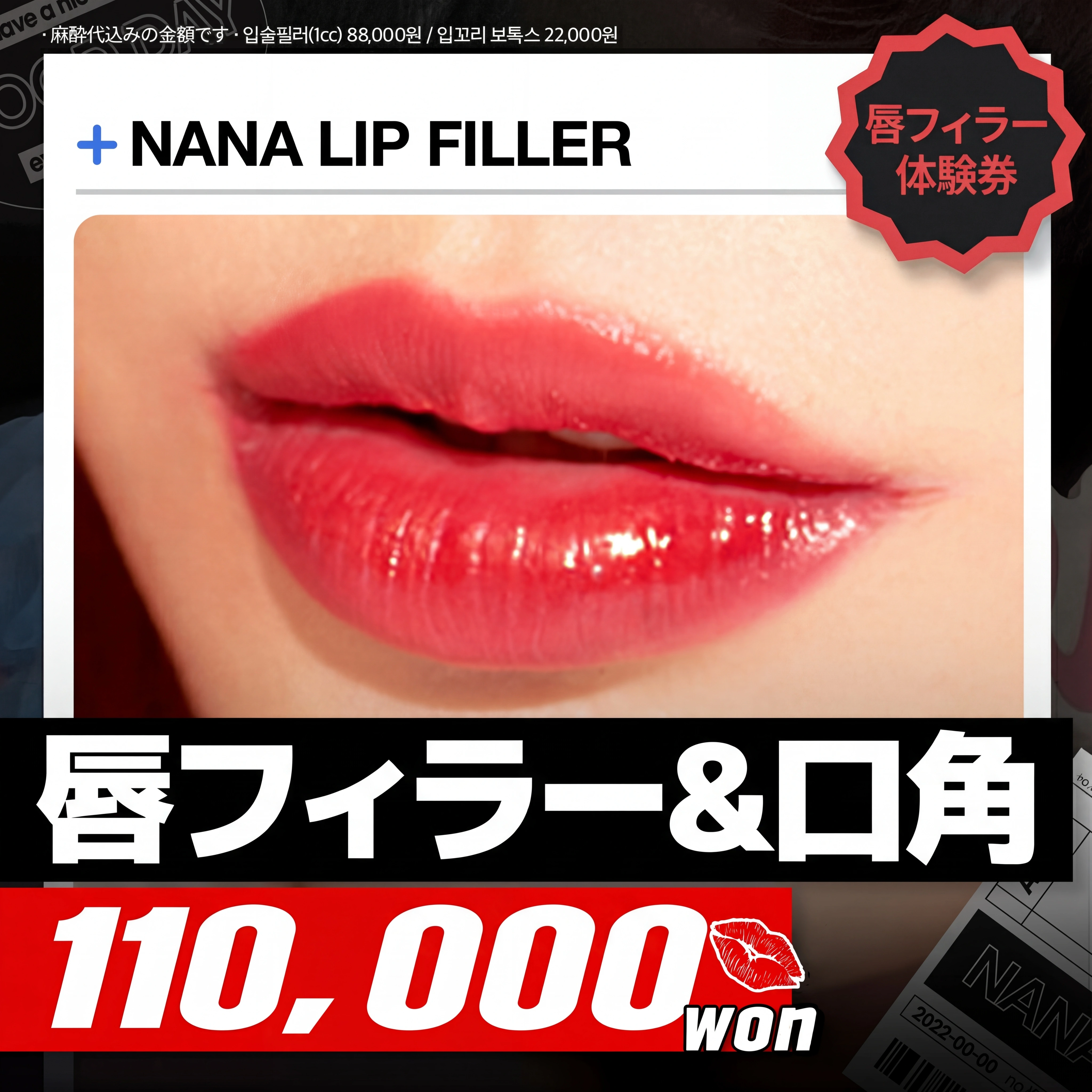 ナナ_唇フィラー＆口角ボトックス