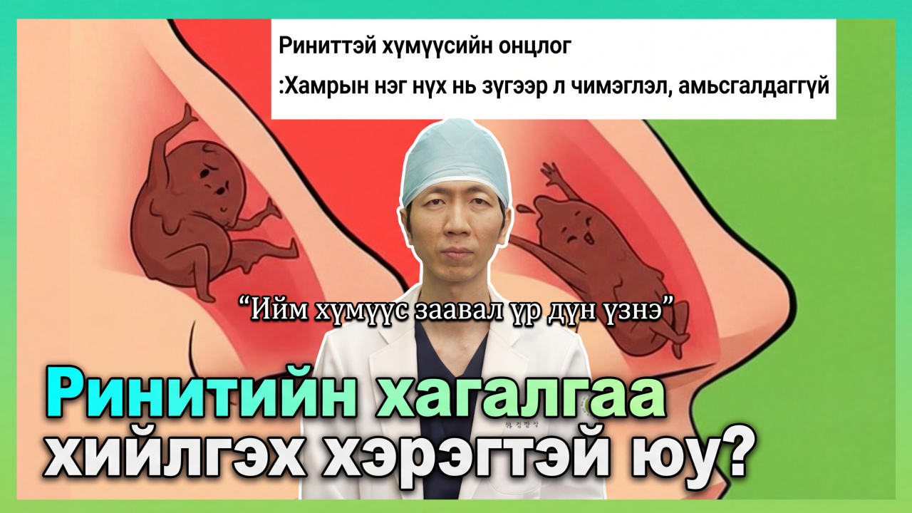 Хамрын үрэвслийн мэс заслын үнэн